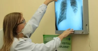 TUBERCULOSE: Coordenadora do Ministério da Saúde tira dúvidas sobre doença