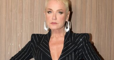 Saiba o estado de saúde de Xuxa Meneghel após cirurgia